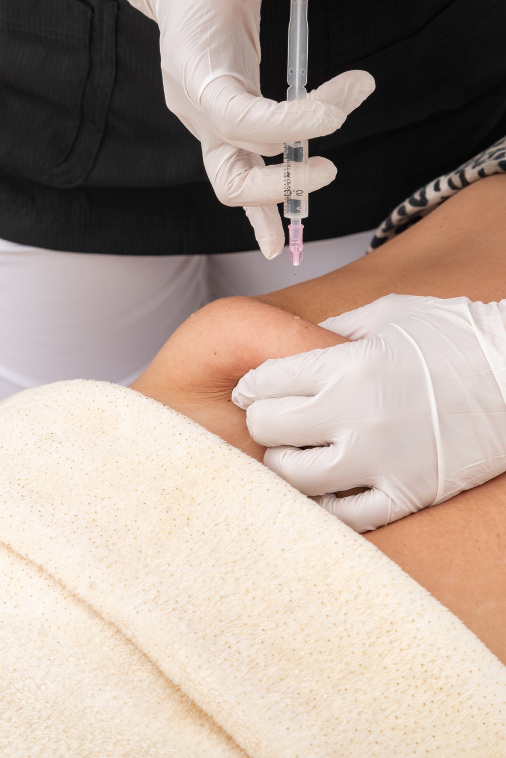 Bioestimulación y biorevitalización inyectable